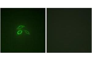 Immunofluorescence analysis of HepG2 cells, using CD227/MUC1 (Phospho-Tyr1229) Antibody. (MUC1 antibody  (pTyr1229))