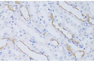 Immunohistochemistry of paraffin-embedded Mouse kidney using Aquaporin 4 Polyclonal Antibody at dilution of 1:50 (40x lens). (Aquaporin 4 antibody)