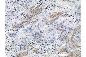 ABIN6255087 and ABIN6267322 at 1/100 staining human normal placenta tissue by IHC-P.