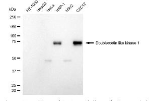 Western blotting analysis using doublecortin like kinase 1 antibody (ABIN7798387).