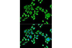 Immunofluorescence analysis of HeLa cells using SH3GL2 antibody (ABIN6132118, ABIN6147725, ABIN6147726 and ABIN6221363). (SH3G2 antibody  (AA 1-270))