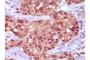 Immunohistochemistry (IHC) image for anti-Mismatch Repair Protein 2 (MSH2) antibody (ABIN2464085) (MSH2 antibody)