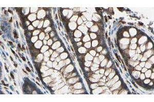 ABIN6278833 at 1/100 staining Rat colon tissue by IHC-P. (SAG antibody  (Internal Region))