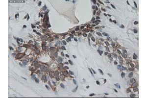 Immunohistochemical staining of paraffin-embedded breast using anti-KRT18 (ABIN2452646) mouse monoclonal antibody.