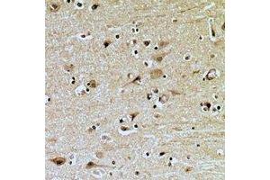 Immunohistochemical analysis of ZNRF2 staining in human brain formalin fixed paraffin embedded tissue section. (ZNRF2 antibody  (C-Term))