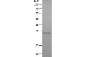 GLO1 Protein (AA 2-184) (His tag)