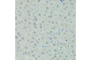 Immunohistochemistry (Paraffin-embedded Sections) (IHC (p)) image for anti-Regulator of Chromosome Condensation 1 (RCC1) (AA 1-240) antibody (ABIN6146817)