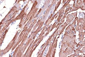 Immunohistochemistry of paraffin-embedded rat heart using Tropomyosin 1 Rabbit mAb (ABIN7271013) at dilution of 1:100 (40x lens). (Tropomyosin antibody)