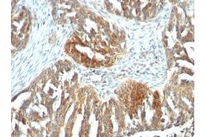Image no. 2 for anti-Vascular Endothelial Growth Factor A (VEGFA) antibody (ABIN6168158) (VEGFA antibody)