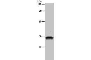 Western Blot analysis of 293T cell using UPK3B Polyclonal Antibody at dilution of 1:1000 (Uroplakin 3B antibody)