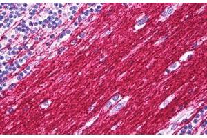 Anti-PLP1 antibody IHC staining of human brain cerebellum, neuropil.