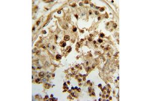 Formalin-fixed and paraffin-embedded human testis tissue reacted with HSD17B3 Antibody (Center), which was peroxidase-conjugated to the secondary antibody, followed by DAB staining. (HSD17B3 antibody  (AA 89-118))