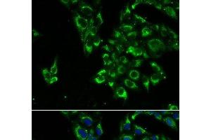 Immunofluorescence analysis of U2OS cells using TSHB Polyclonal Antibody (TSHB antibody)