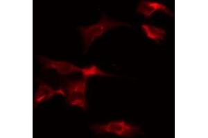 ABIN6275544 staining Hela by IF/ICC. (VRK2 antibody  (Internal Region))