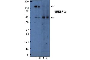 Western Blotting (WB) image for anti-Sterol Regulatory Element Binding Transcription Factor 2 (SREBF2) (AA 833-1141) antibody (ABIN967564) (SREBF2 antibody  (AA 833-1141))