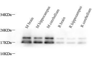 Western Blot analysis of various samples using MBP Polyclonal Antibody at dilution of 1:1000. (MBP antibody)