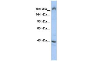 EIF4G1 antibody used at 1 ug/ml to detect target protein. (EIF4G1 antibody  (Middle Region))