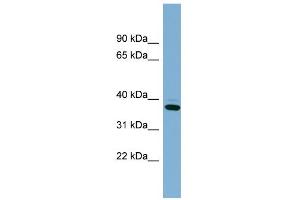 WB Suggested Anti-XAF1 Antibody Titration: 0. (XAF1 antibody  (Middle Region))