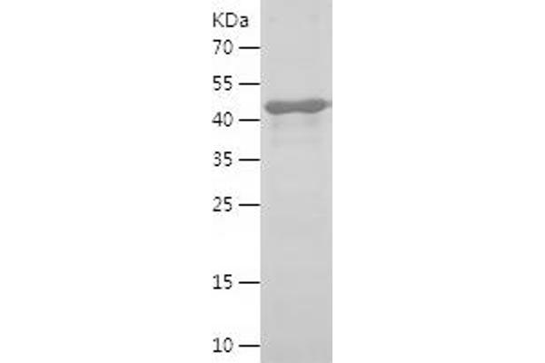 LTBP1 Protein (AA 24-265) (His-IF2DI Tag)