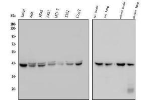 Western blot analysis of GNAQ using anti-GNAQ antibody (ABIN6719526).
