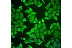 Immunofluorescence analysis of U2OS cells using NGB Polyclonal Antibody (Neuroglobin antibody)