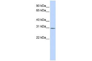 WB Suggested Anti-YIF1B Antibody Titration:  0.