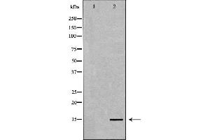 Western blot analysis of extracts of HeLa, using Histone H3K4me3 Antibody. (Histone 3 antibody  (H3K4me3))