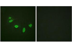 Immunofluorescence staining of methanol-fixed HeLa cells using ETS1 (Phospho-Thr38) Antibody. (ETS1 antibody  (pThr38))