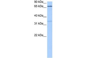 WB Suggested Anti-PADI2 Antibody Titration: 0. (PADI2 antibody  (Middle Region))