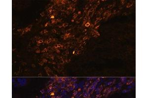 Immunofluorescence analysis of Human lung cancer cells using KRT7 Polyclonal Antibody at dilution of 1:100. (Cytokeratin 7 antibody)