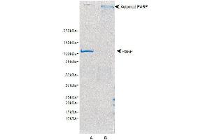 SDS-PAGE/Coomassie Blue staining of PARP1. (PARP1 Protein)