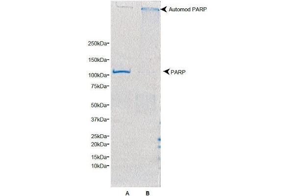PARP1 蛋白
