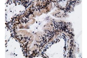 Immunohistochemistry (IHC) image for anti-EPM2A (Laforin) Interacting Protein 1 (EPM2AIP1) antibody (ABIN1498047) (EPM2AIP1 antibody)