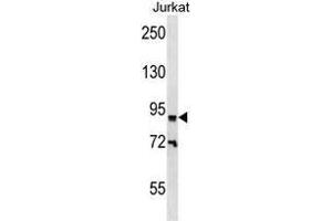 ZNF780B Antibody (N-term) western blot analysis in Jurkat cell line lysates (35 µg/lane).
