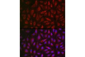 Immunofluorescence analysis of U2OS cells using  Rabbit pAb (ABIN3021778, ABIN3021779, ABIN3021780, ABIN1512563 and ABIN6215865) at dilution of 1:200 (40x lens). (ALDH2 antibody  (AA 1-380))