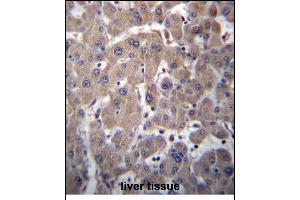YIPF1 Antibody (N-term) (ABIN656786 and ABIN2846004) immunohistochemistry analysis in formalin fixed and paraffin embedded human liver tissue followed by peroxidase conjugation of the secondary antibody and DAB staining. (YIPF1 antibody  (N-Term))
