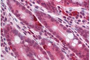 Human Small Intestine (formalin-fixed, paraffin-embedded) stained with MC4R antibody ABIN214186 at 5 ug/ml followed by biotinylated goat anti-rabbit IgG secondary antibody ABIN481713, alkaline phosphatase-streptavidin and chromogen. (MC4R antibody  (AA 21-33))