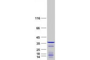 Validation with Western Blot (CCDC124 Protein (Transcript Variant 1) (Myc-DYKDDDDK Tag))