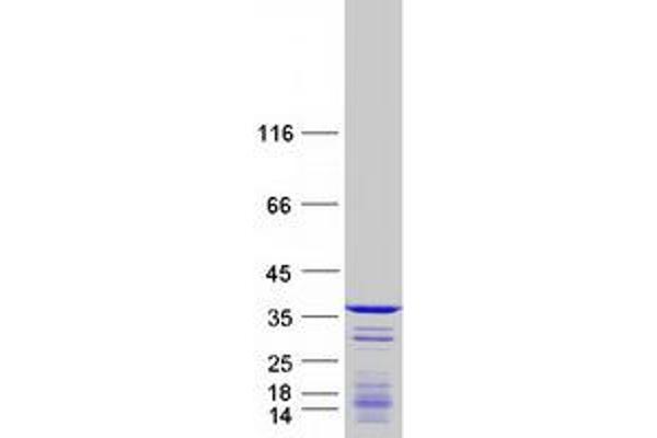 CCDC124 Protein (Transcript Variant 1) (Myc-DYKDDDDK Tag)