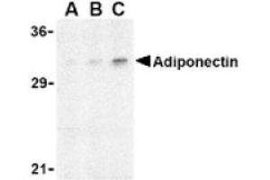 Image no. 1 for anti-Adiponectin (ADIPOQ) (N-Term) antibody (ABIN265161) (ADIPOQ antibody  (N-Term))