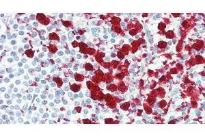 Immunohistochemistry of paraffin-embedded Spleen tissue using CD42b Polyclonal Antibody at dilution of 1:80. (CD42b antibody)