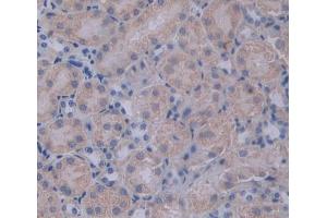 Used in DAB staining on fromalin fixed paraffin- embedded Kidney tissue (PCSK1 antibody  (AA 244-530))