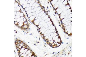 Immunohistochemistry (IHC) image for anti-Ribosomal Protein S20 (RPS20) antibody (ABIN7270017)