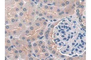 DAB staining on IHC-P; Samples: Mouse Kidney Tissue (DC-SIGN/CD209 antibody  (AA 115-238))