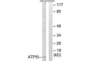 Western blot analysis of extracts from COLO cells, using ATP5I antibody. (ATP5I antibody  (Internal Region))