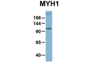 Host:  Rabbit  Target Name:  MYH1  Sample Type:  OVCAR-3  Antibody Dilution:  1. (MYH1 antibody  (N-Term))
