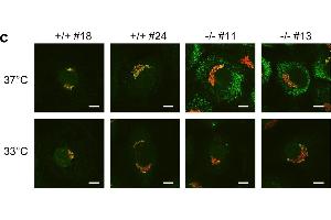 Immunofluorescence (Cultured Cells) (IF (cc)) image for anti-COL1A2/COL1A1 antibody (ABIN5596819)