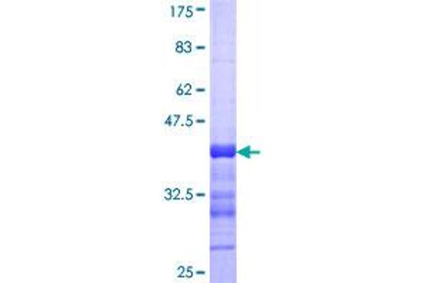 YAP1 Protein (AA 53-161) (GST tag)