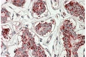 AP21267PU-N ACO2 Antibody staining of paraffin embedded Human Breast at 3. (ACO2 antibody  (Internal Region))