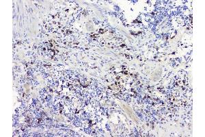IHC analysis of RRBP1 using anti-RRBP1 antibody (ABIN6719628). (RRBP1 antibody)